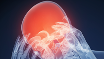 Concussion Advice